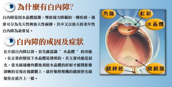 白内障手术后吃什么好？